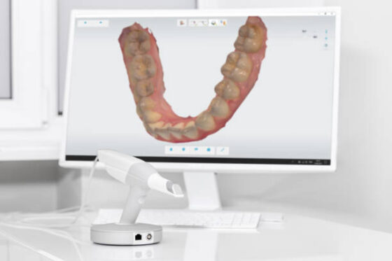 How 3d oral scanner work