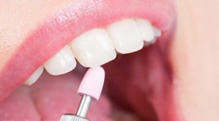 Teeth-polishing