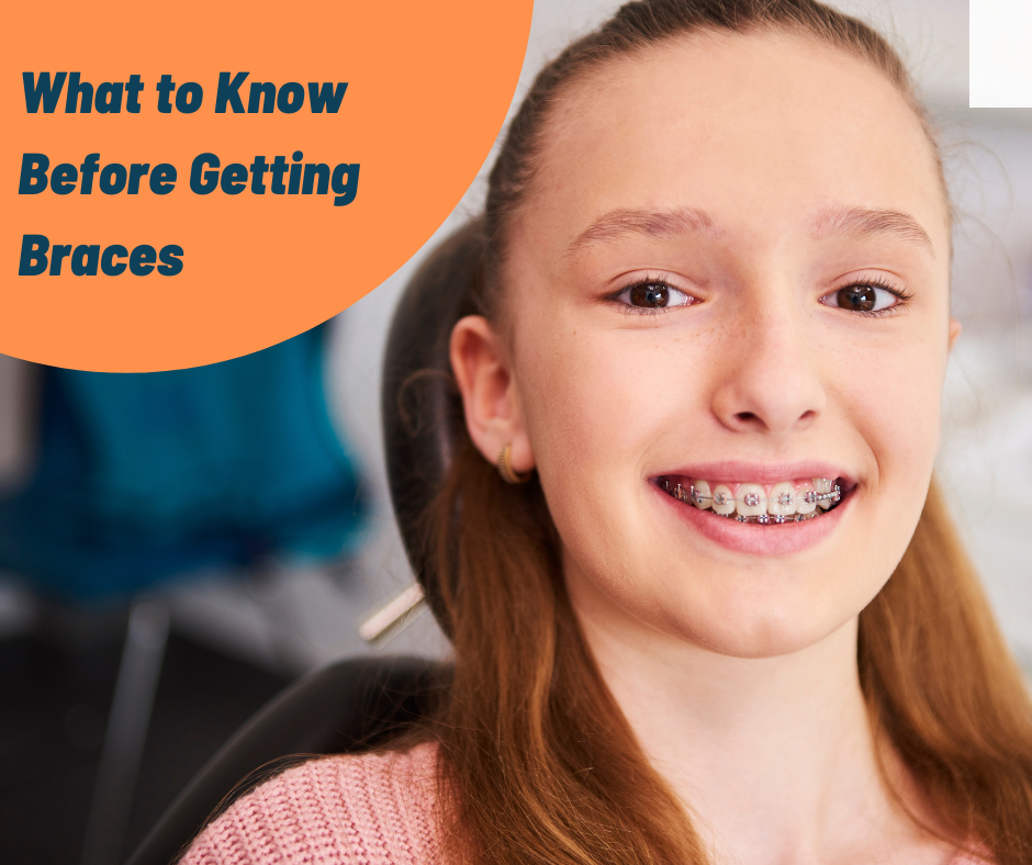 What To Know Before Getting Braces | The Team Dental, Kharadi