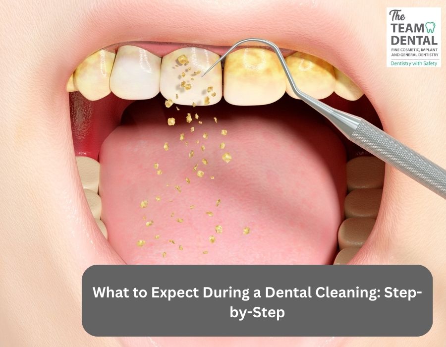 What to Expect During a Dental Cleaning | Dr. Samidha Patil