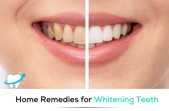 Home Remedies For Teeth Whitening