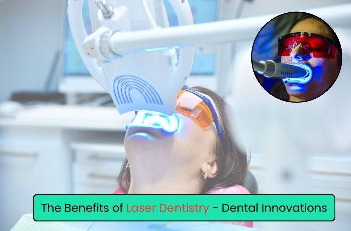 The Benefits of Laser Dentistry - Dental Innovations