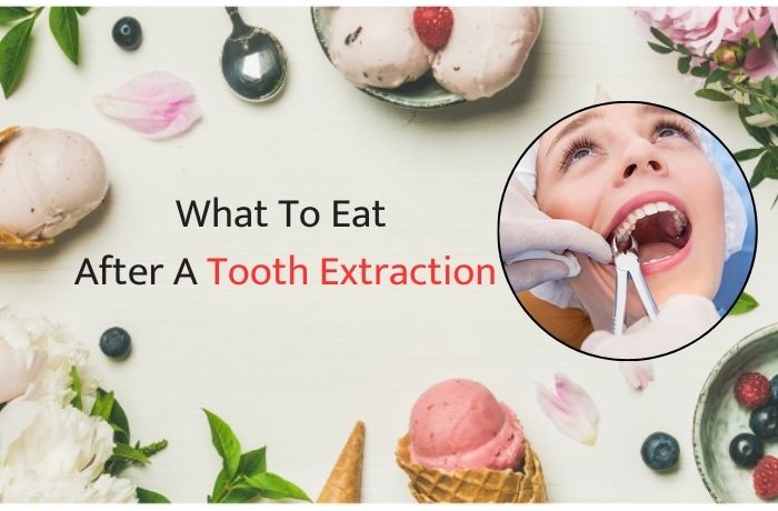 What To Eat After A Tooth Extraction: A Guide for Quick Healing