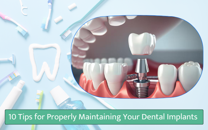 . 10 Tips for Properly Maintaining Your Dental Implants