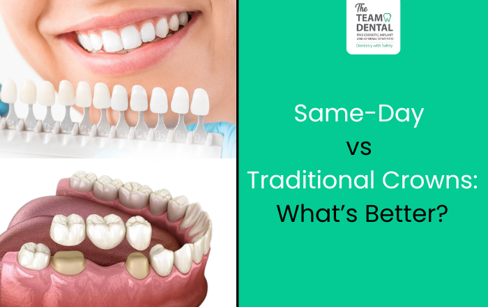 Same-Day Crowns vs Traditional Crowns: Which Should You Choose?
