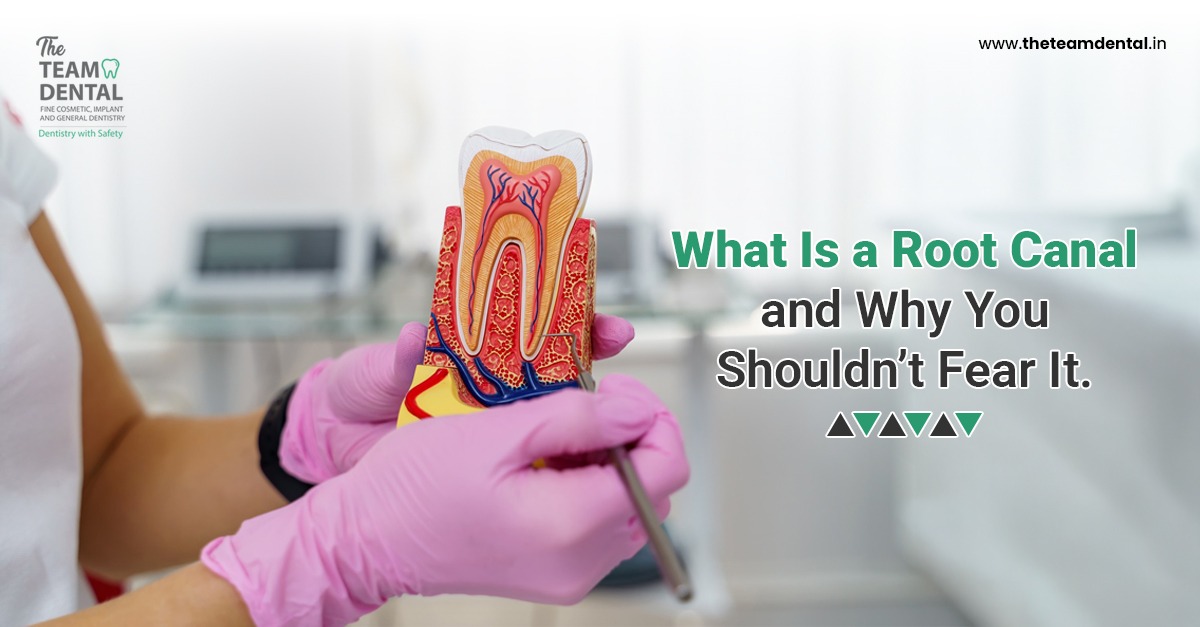 What Is a Root Canal and Why You Shouldn’t Fear It