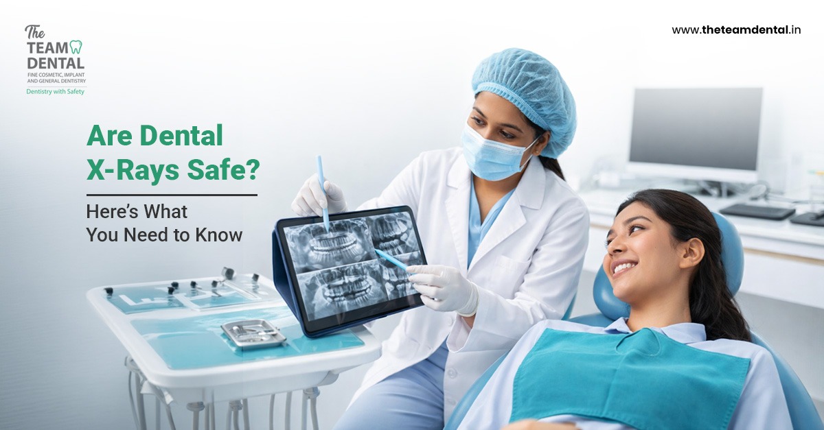 Are Dental X-Rays Safe? Here’s What You Need to Know