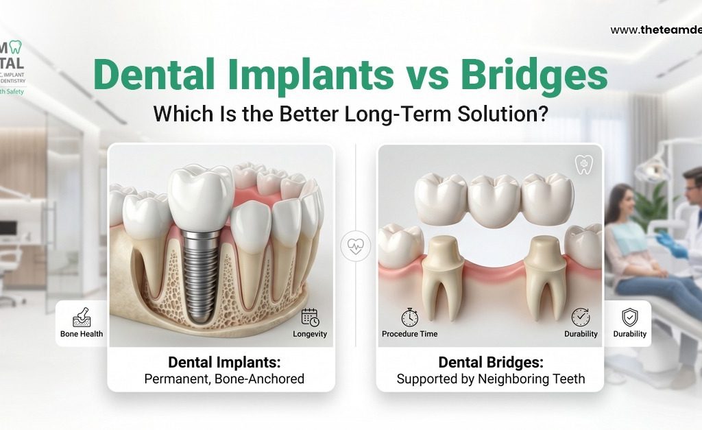 Dental Implants vs Bridges: Which Is the Better Long-Term Solution?