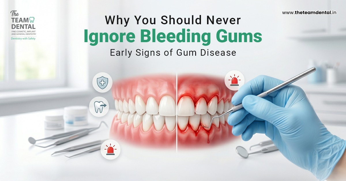 Why You Should Never Ignore Bleeding Gums: Early Signs of Gum Disease