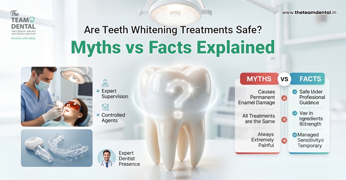 Are Teeth Whitening Treatments Safe? Myths vs Facts Explained