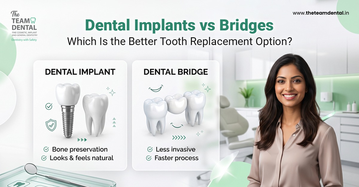 Dental Implants vs Bridges: Which Is the Better Tooth Replacement Option?