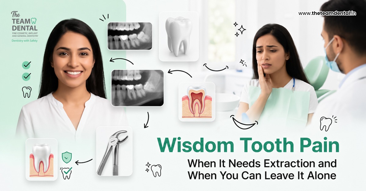Wisdom Tooth Pain: When It Needs Extraction and When You Can Leave It Alone