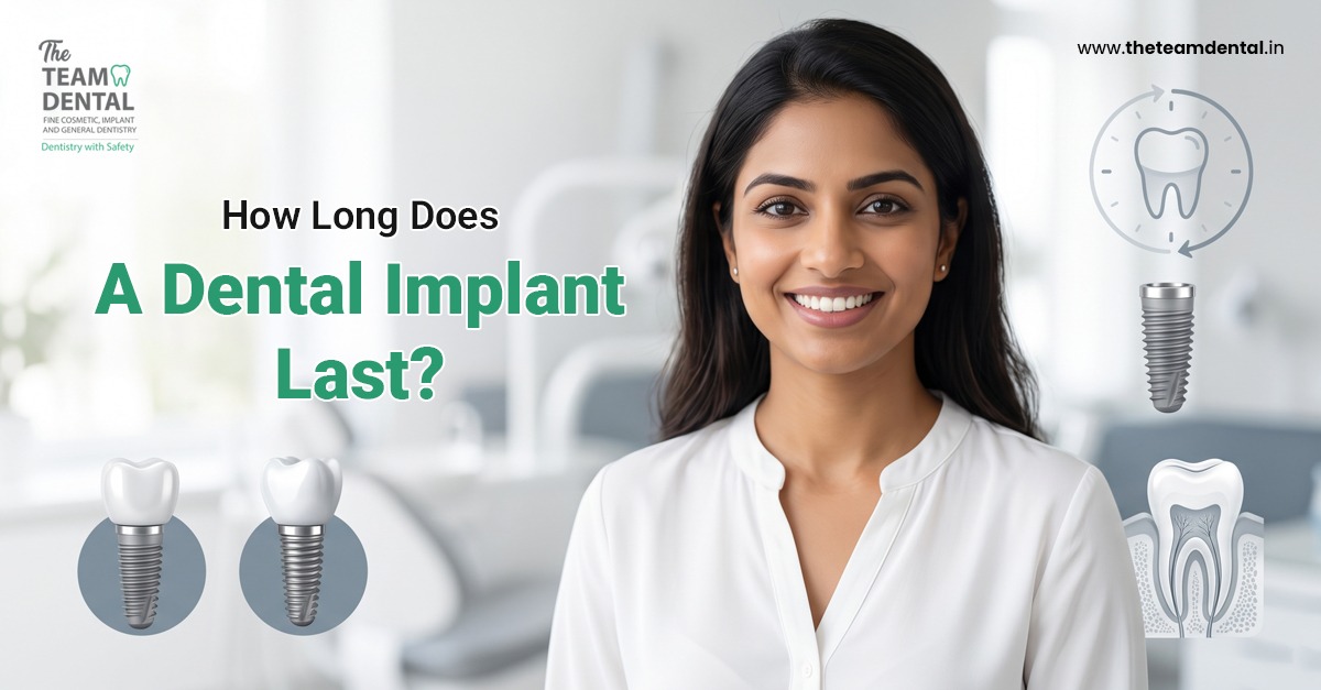How Long Does a Dental Implant Last? A Complete Guide