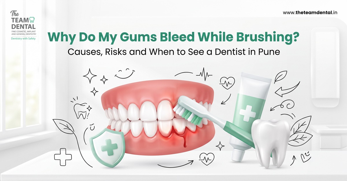 Why Do My Gums Bleed While Brushing? Causes, Risks & When to See a Dentist in Pune